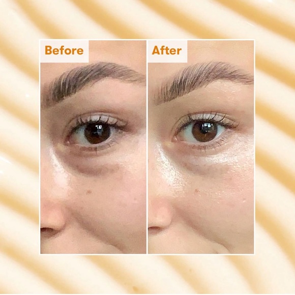 🌿 REN Clean Skincare Brightening Dark Circle Eye Cream - Picture 3 of 8